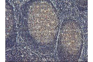 Image no. 6 for anti-Activating Signal Cointegrator 1 Complex Subunit 1 (ASCC1) antibody (ABIN1496741) (ASCC1 anticorps)