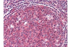 Human Tonsil (formalin-fixed, paraffin-embedded) stained with CD19followed by biotinylated goat anti-rabbit IgG secondary antibody, alkaline phosphatase-streptavidin and chromogen. (CD19 anticorps  (C-Term))