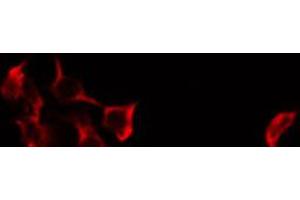 ABIN6274642 staining HeLa by IF/ICC.