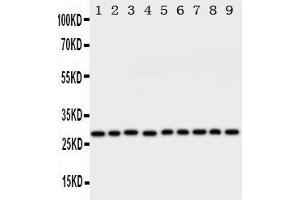 Western Blotting (WB) image for anti-Peroxiredoxin 3 (PRDX3) (AA 239-256), (C-Term) antibody (ABIN3044200)