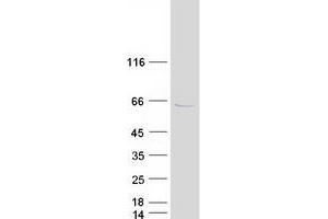 Validation with Western Blot