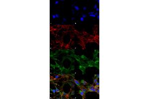 Immunocytochemistry/Immunofluorescence analysis using Mouse Anti-Acrolein Monoclonal Antibody, Clone 10A10 . (Acrolein anticorps  (APC))
