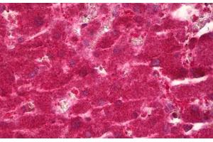 Anti-CYP39A1 antibody IHC staining of human liver.