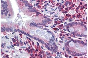 Human Small Intestine: Formalin-Fixed, Paraffin-Embedded (FFPE)