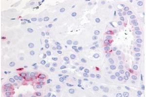 Human Kidney (formalin-fixed, paraffin-embedded) stained with PTGER2 antibody ABIN213469 at 20-40 ug/ml followed by biotinylated goat anti-rabbit IgG secondary antibody ABIN481713, alkaline phosphatase-streptavidin and chromogen.
