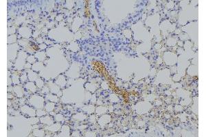 ABIN6276441 at 1/100 staining Mouse lung tissue by IHC-P.