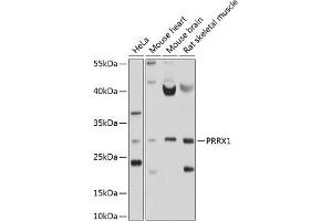 Western blot analysis of extracts of various cell lines, using PRRX1 antibody (ABIN6128507, ABIN6146277, ABIN6146278 and ABIN6214409) at 1:1000 dilution. (PRRX1 anticorps  (AA 1-90))