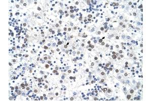 FECH antibody was used for immunohistochemistry at a concentration of 4-8 ug/ml to stain Hepatocytes (arrows) in Human Liver. (FECH anticorps)