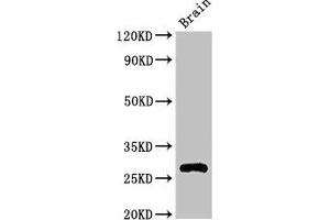 Western Blot Positive WB detected in: Mouse brain tissue All lanes: DNAJC4 antibody at 3. (DNAJC4 anticorps  (AA 1-155))