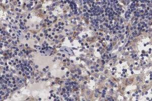 ABIN6266699 at 1/100 staining human lymph node tissue sections by IHC-P.