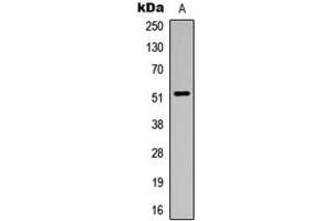 Western blot analysis of ALDH3B1 expression in HuvEc (A) whole cell lysates. (ALDH3B1 anticorps  (Center))