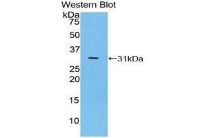 Detection of Recombinant IkBz, Mouse using Polyclonal Antibody to Inhibitory Subunit Of NF Kappa B Zeta (IkBz)