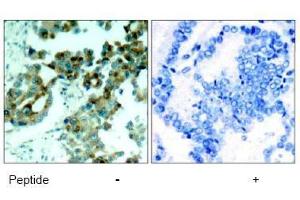 Image no. 1 for anti-Ribosomal Protein S6 (RPS6) (AA 233-237) antibody (ABIN197471) (RPS6 anticorps  (AA 233-237))
