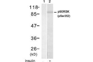 Image no. 1 for anti-Ribosomal Protein S6 Kinase, 90kDa, Polypeptide 1 (RPS6KA1) (pSer352) antibody (ABIN319221) (RPS6KA1 anticorps  (pSer352))