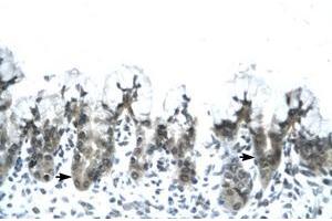 Image no. 1 for anti-Adiponectin (ADIPOQ) (AA 77-126) antibody (ABIN202115) (ADIPOQ anticorps  (AA 77-126))
