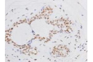 Immunohistochemistry (Paraffin-embedded Sections) (IHC (p)) image for anti-BMI1 Polycomb Ring Finger Oncogene (BMI1) antibody (ABIN1112825) (BMI1 anticorps)