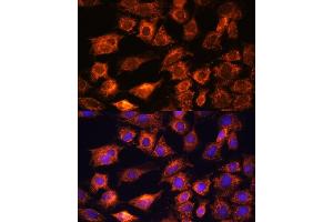 Immunofluorescence analysis of C6 cells using PTCD1 antibody (ABIN7269203) at dilution of 1:100. (PTCD1 anticorps  (AA 435-537))