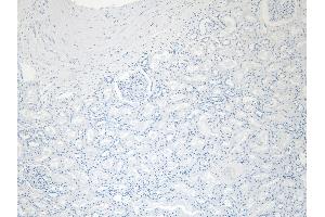 (ABIN185594) Negative Control showing staining of paraffin embedded Human Kidney, with no primary antibody