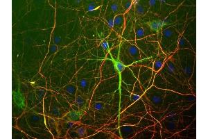 shows rat mixed neuron/glial cultures stained with mouse monoclonal antibody to neurofilament subunit NF-L MCA-7D1 (green) and ABIN1842223, chicken antibody to neurofilament NF-H.