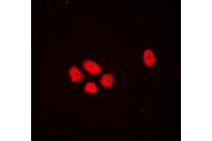 Immunofluorescent analysis of EXO1 staining in A431 cells.