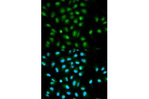 Immunofluorescence analysis of HeLa cells using PYCARD antibody (ABIN5970516). (PYCARD anticorps)