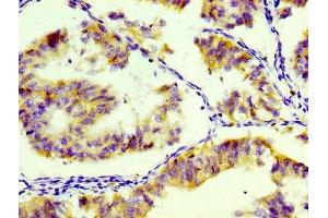 IHC image of ABIN7127283 diluted at 1:100 and staining in paraffin-embedded human endometrial tissue performed on a Leica BondTM system.