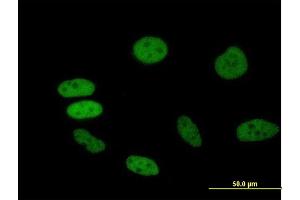 Immunofluorescence of purified MaxPab antibody to BRD2 on HeLa cell. (BRD2 anticorps  (AA 1-801))