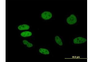 Immunofluorescence of purified MaxPab antibody to BRD2 on HeLa cell.