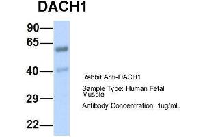 Host:  Rabbit  Target Name:  DACH1  Sample Type:  Human Fetal Muscle  Antibody Dilution:  1. (DACH1 anticorps  (N-Term))