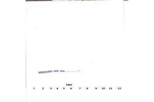 Image no. 2 for anti-Colony Stimulating Factor 2 (Granulocyte-Macrophage) (CSF2) antibody (ABIN465747)