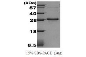 Figure annotation denotes ug of protein loaded and % gel used. (ADIPOQ Protéine)