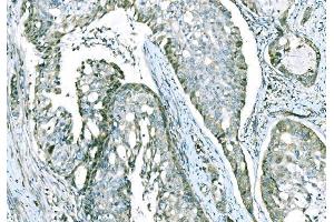 IHC analysis of CD101 using anti-CD101 antibody (ABIN7601981). (CD101 anticorps  (AA 53-904))