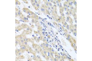 Immunohistochemistry of paraffin-embedded human liver injury using ITPKB antibody (ABIN5972108) at dilution of 1/100 (40x lens). (ITPKB anticorps)