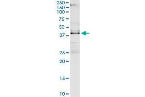Immunoprecipitation of VRK1 transfected lysate using anti-VRK1 MaxPab rabbit polyclonal antibody and Protein A Magnetic Bead , and immunoblotted with VRK1 purified MaxPab mouse polyclonal antibody (B01P) .