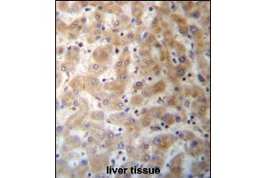 DHFRL1 Antibody (Center) (ABIN657287 and ABIN2846374) immunohistochemistry analysis in formalin fixed and paraffin embedded human liver tissue followed by peroxidase conjugation of the secondary antibody and DAB staining. (DHFRL1 anticorps  (AA 45-74))