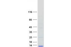 Validation with Western Blot
