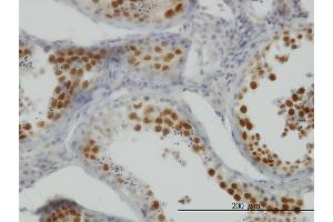 Immunoperoxidase of monoclonal antibody to NEK2 on formalin-fixed paraffin-embedded human testis.