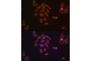 Immunofluorescence analysis of H9C2 cells using TRH Rabbit pAb (ABIN7270826) at dilution of 1:100. (TRH anticorps  (AA 100-200))