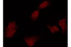 anti-C-Abl Oncogene 1, Non-Receptor tyrosine Kinase (ABL1) (pTyr412) antibody