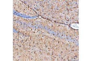 IHC analysis of Aquaporin 4 using anti-Aquaporin 4 antibody (ABIN3043789). (Aquaporin 4 anticorps  (C-Term))