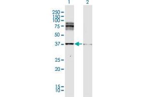 Western Blot analysis of DCT expression in transfected 293T cell line by DCT MaxPab polyclonal antibody. (DCT anticorps  (AA 1-519))