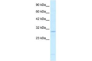 RALY antibody used at 0. (Raly anticorps  (N-Term))