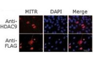 Immunofluorescence staining of MITR (HDAC9) for a compartmentalization study in undifferentiated transfected C2C12 myoblasts.