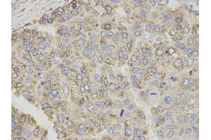 Immunohistochemistry (IHC) image for anti-Carnitine Palmitoyltransferase 1A (Liver) (CPT1A) antibody (ABIN1876495) (CPT1A anticorps)