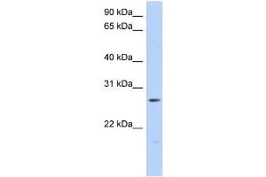 WB Suggested Anti-MTHFS Antibody Titration: 0. (MTHFS anticorps  (Middle Region))