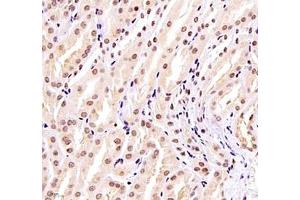 Immunohistochemistry of paraffin embedded mouse kidney using ZKSCAN4 (ABIN7076265) at dilution of 1:1300 (400x lens)