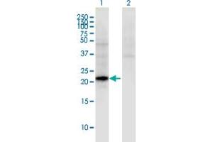 Western Blot analysis of CGB5 expression in transfected 293T cell line by CGB5 monoclonal antibody (M02), clone 2E7. (CGB5 anticorps  (AA 1-165))