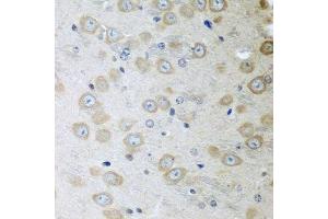Immunohistochemistry of paraffin-embedded mouse brain using ATAD3A antibody. (ATAD3A anticorps  (AA 1-240))
