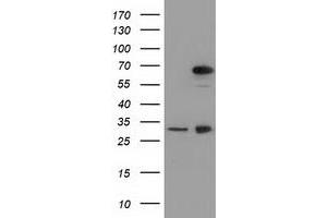 Western Blotting (WB) image for anti-Membrane Protein, Palmitoylated 3 (MAGUK P55 Subfamily Member 3) (MPP3) antibody (ABIN1499549) (MPP3 anticorps)