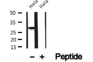 Western blot analysis of extracts of HepG2 cells, using PMM2 antibody. (PMM2 anticorps  (C-Term))